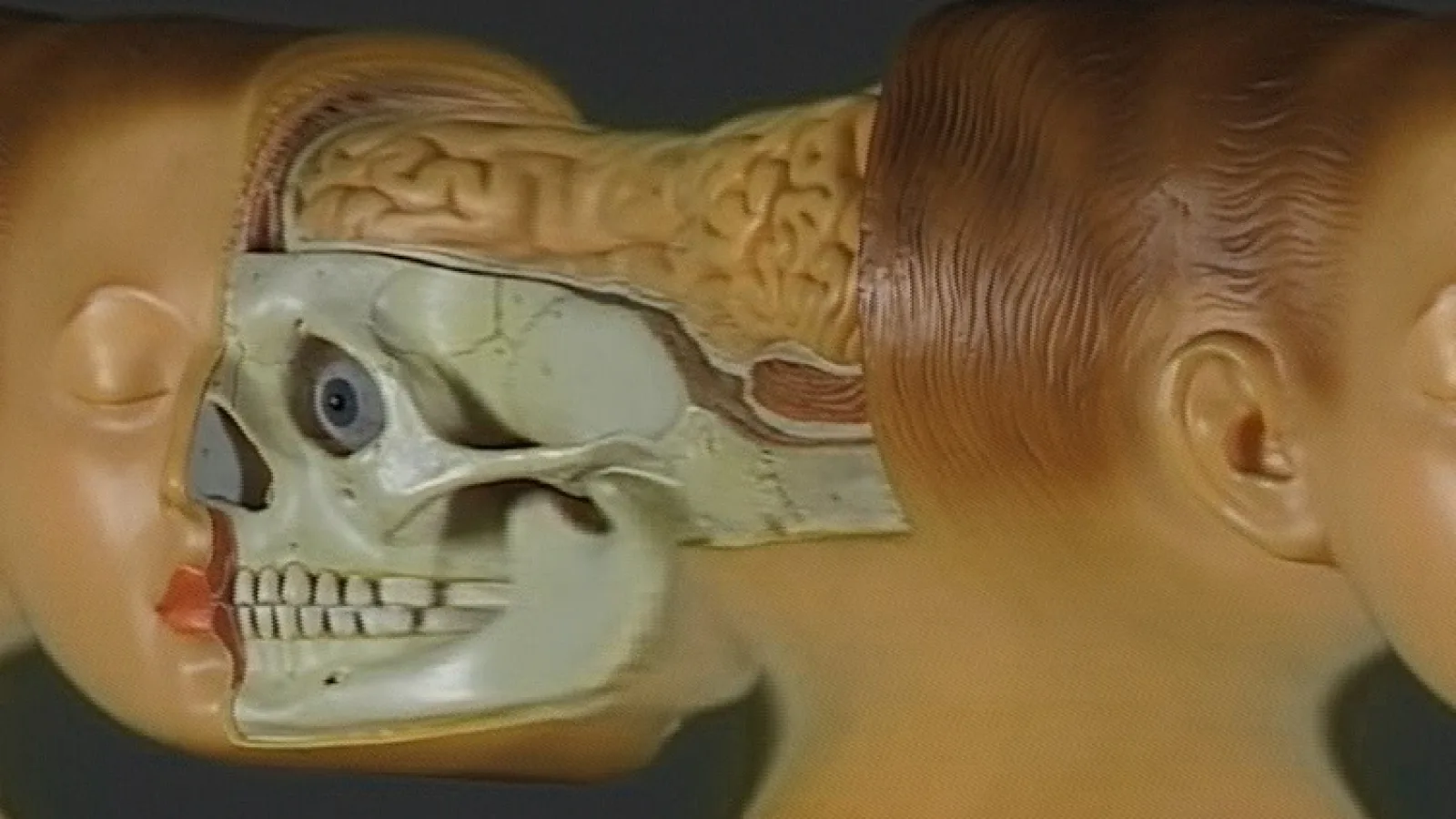 tx-transformation of a head, 1998