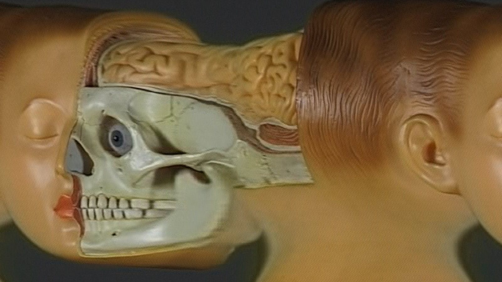 tx-transformation of a head, 1998